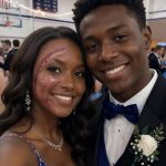 A Boy Asked Me to Dance at Prom Because No One Else Would Due to My Scars – The Next Day, His Parents and Officers Showed up at My Door